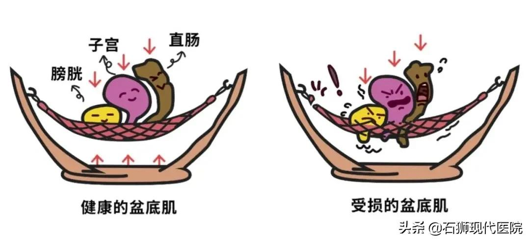 产后想要做健康辣妈,这些雷区要记得避开哦