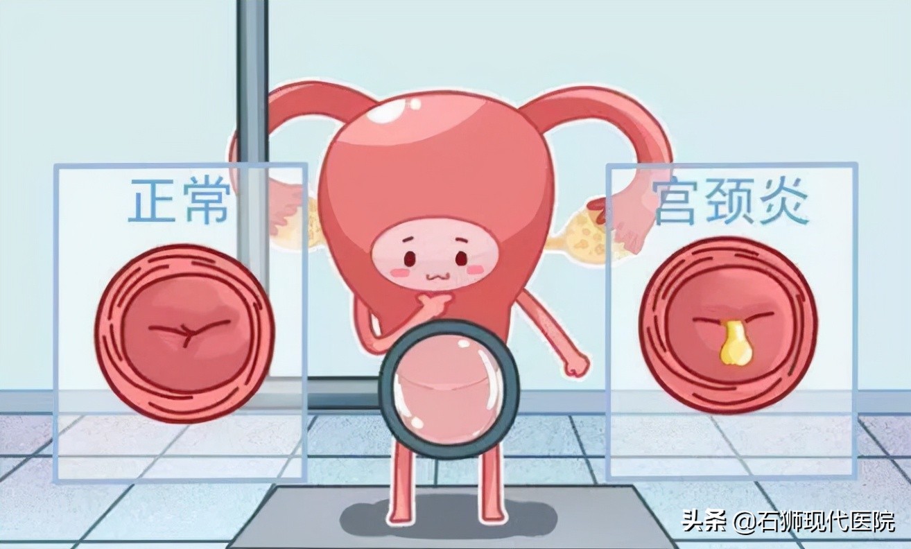 妇科炎症也会传染,大部分女性居然都不知道这些