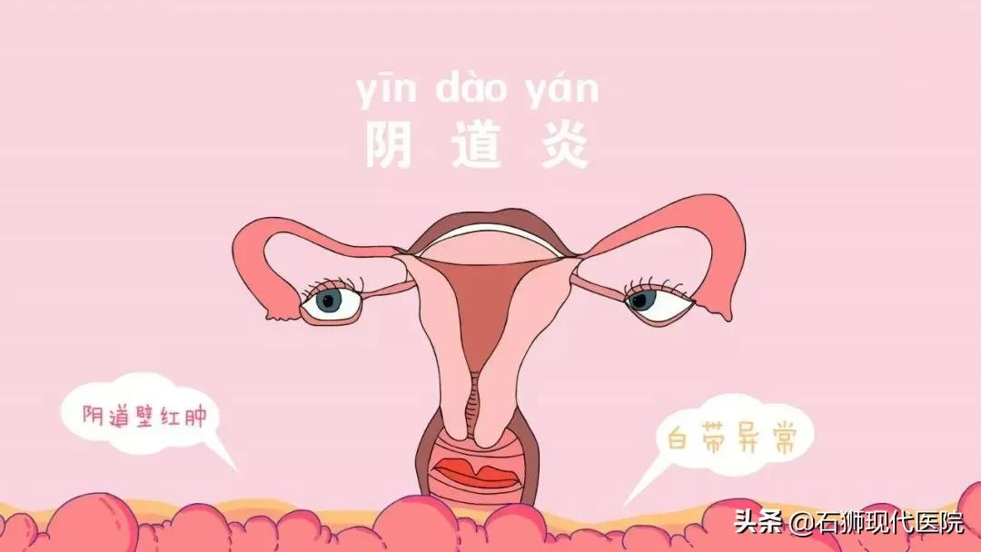 妇科炎症也会传染,大部分女性居然都不知道这些