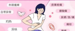 女性难“炎”之隐—阴道炎