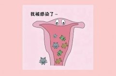 白带变成豆腐渣样是怎么回事？