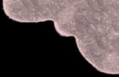 30岁以后，这些妇科检查你一定要定期做