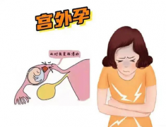 怀孕怀在“摇篮”外？这不是奇迹，是