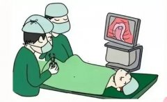 为什么HPV和TCT要联合筛查？没症状要做