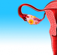 输卵管通而不畅，到底是通还是不通？