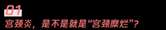 宫颈炎症：看似普通却也不应忽视，你